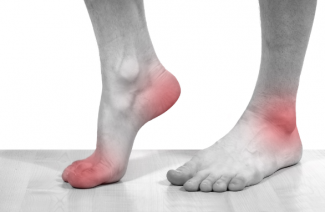 Arthrite goutteuse