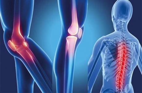 Seronegative Spondylitis