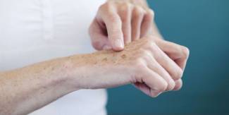 Taches de vieillesse sur les mains
