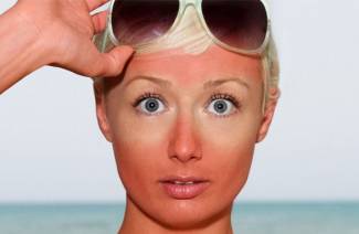 Comment enlever les rougeurs après le bronzage