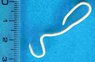 Pinworm kirminai