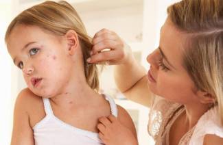 Comment traiter l'urticaire