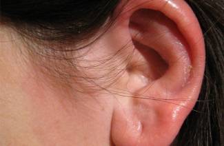 Otitis externa