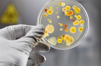 Test de salmonellose