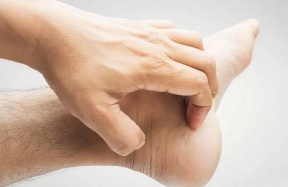 Signes de mycose des pieds