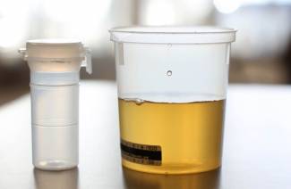 Sucre dans l'urine