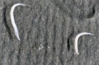 Pinworm medicina
