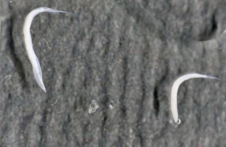 Pinworm medicina