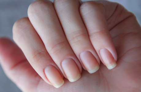 Clotrimazole solution de mycose des ongles