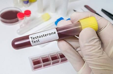 Testosterona tests