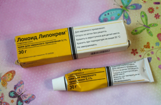 Lokoidas