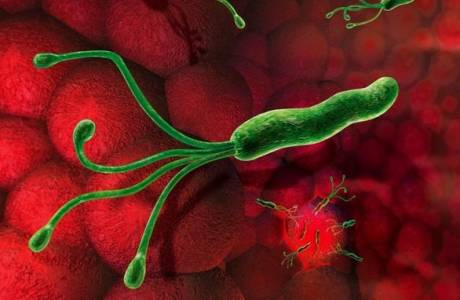 Klebsiella šlapime