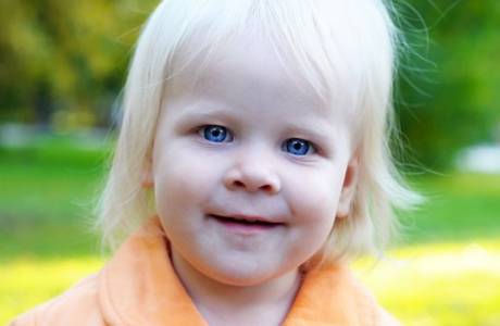 Angelman sendromu