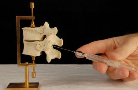 Blokada osteochondrozėje