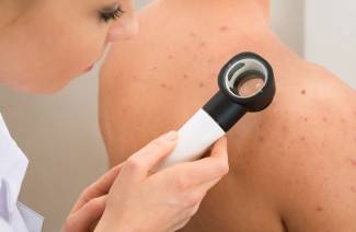 Lipoma ant nugaros