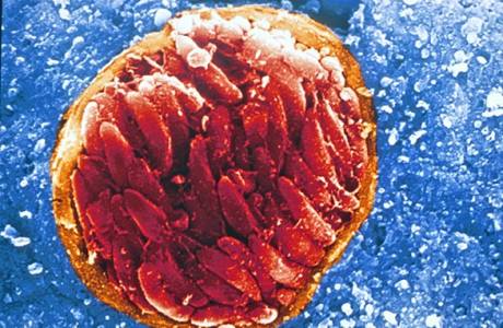 Protozoal enfeksiyonlar