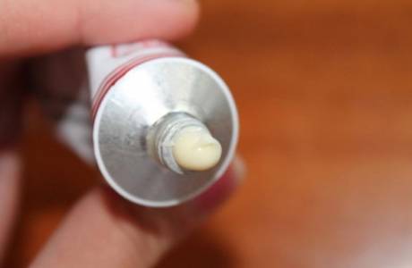 Làm thế nào để hết ngứa với bệnh trĩ
