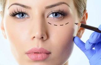 Ei-kirurginen blefaroplastia