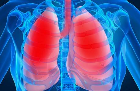 Antibiotiques pour la pneumonie