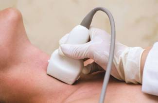 hyperthyroidism