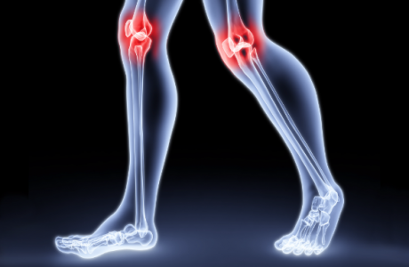 Inflamatii articulare