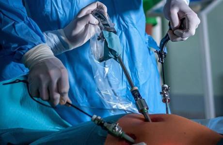 Λαπαροσκόπηση στην γυναικολογία