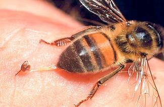 Comment soulager l'enflure après une piqûre d'abeille