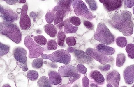 Mycoplasma sukuelimet