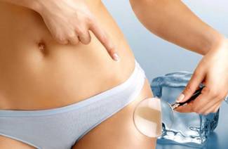 cryolipolysis