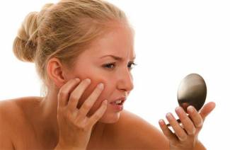 Psoriasis sur le visage
