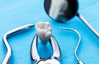 Antibióticos después de la extracción dental.