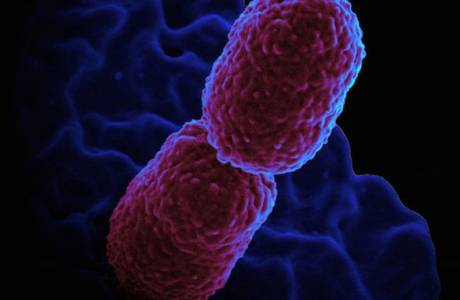 Klebsiella pneumonija