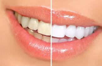 8 façons de blanchir les dents à la maison