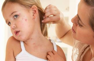 Sintomi del morbillo nei bambini e negli adulti