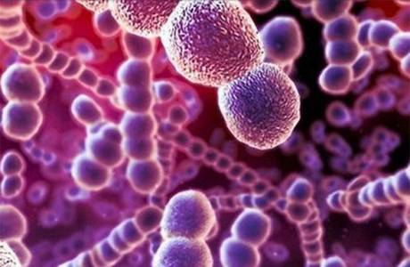 Infezione streptococcica