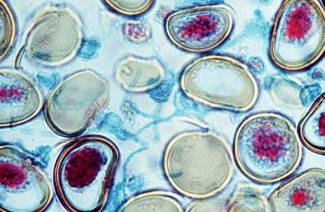 Cellules souches