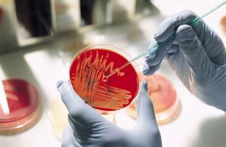 Diagnostic des maladies fongiques