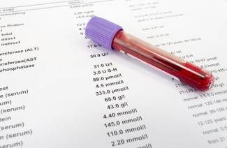 Leukemian verikoe