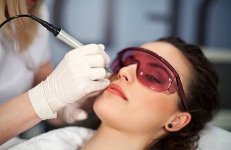Lézer biorevitalizáció