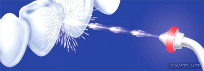 Spray Irrigateur