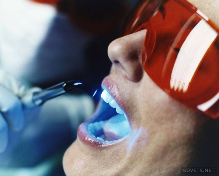 Laser làm trắng răng