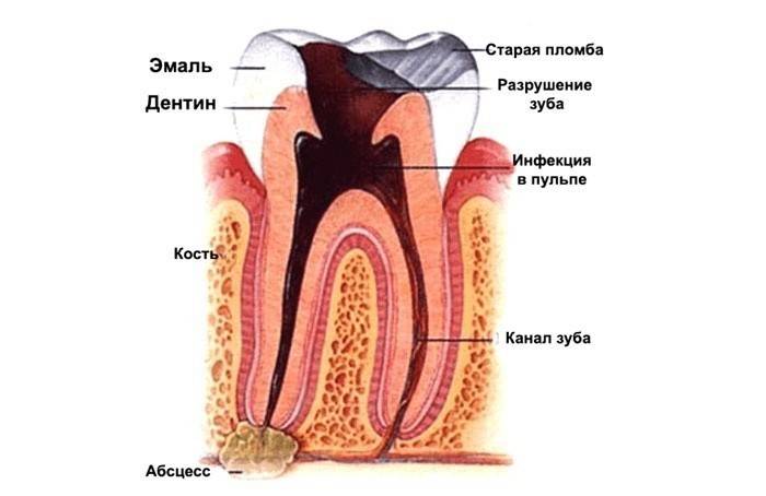 Nguyên nhân đau ở răng đầy