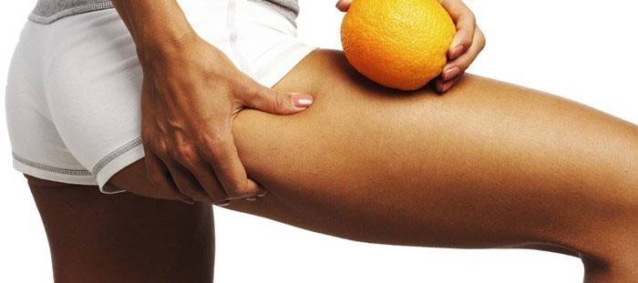 Combattere la cellulite