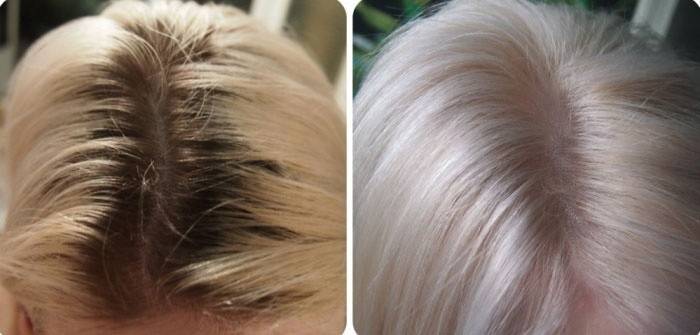 Kết quả của việc làm sáng tóc với peroxide