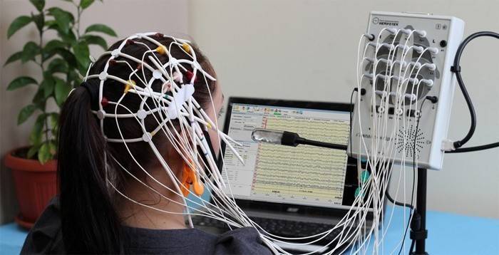 การตรวจสมอง EEG
