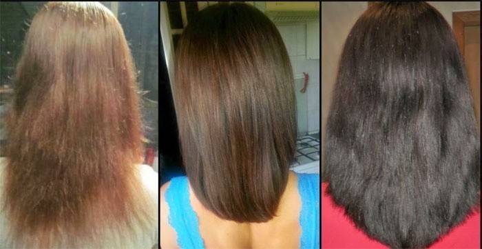 Capelli prima e dopo l'uso di Dimexidum