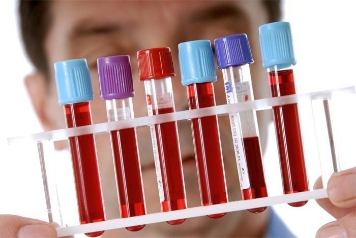 Test sanguin de laboratoire
