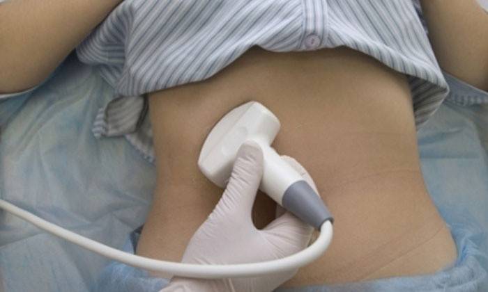 Ultraääni syklin poikkeamien syiden tunnistamiseksi