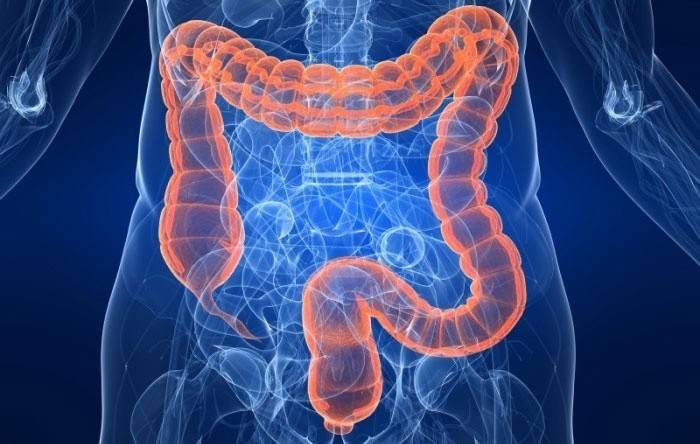 Colitis ulcerosa - Entzündung des Dickdarms