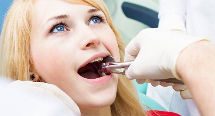 Dentista quita ochos
